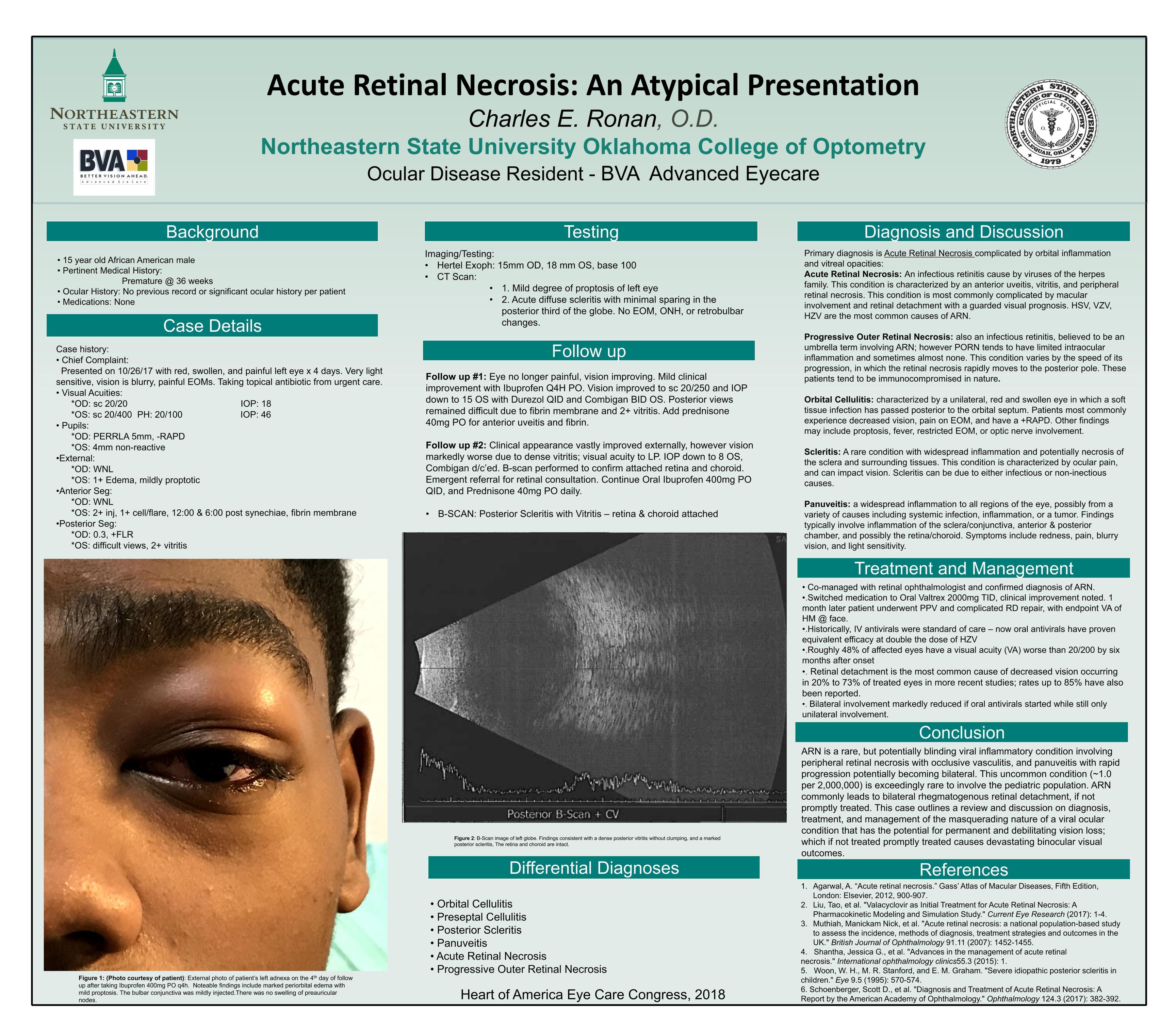 topics for poster presentation in ophthalmology